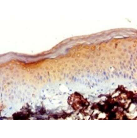 Immunohistochemistry - 39S ribosomal protein L20, mitochondrial Polyclonal Antibody from Signalway Antibody (42677)