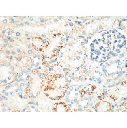 Ki 67 Mouse Monoclonal Antibody from Signalway Antibody (38019) - Antibodies.com