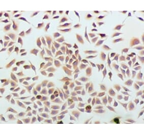Immunohistochemistry - Podocalyxin Monoclonal Antibody from Signalway Antibody (42047) - Antibodies.com