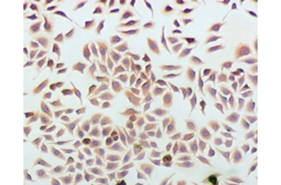 Immunohistochemistry - Podocalyxin Monoclonal Antibody from Signalway Antibody (42047) - Antibodies.com