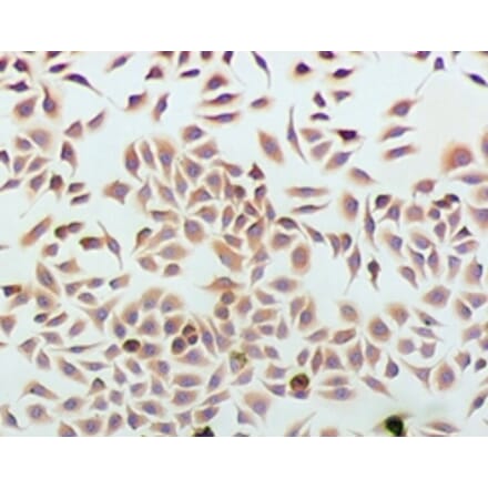 Immunohistochemistry - Podocalyxin Monoclonal Antibody from Signalway Antibody (42047) - Antibodies.com