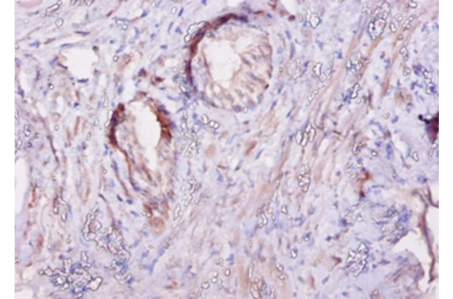 Immunohistochemistry - Calpastatin Polyclonal Antibody from Signalway Antibody (42103) - Antibodies.com