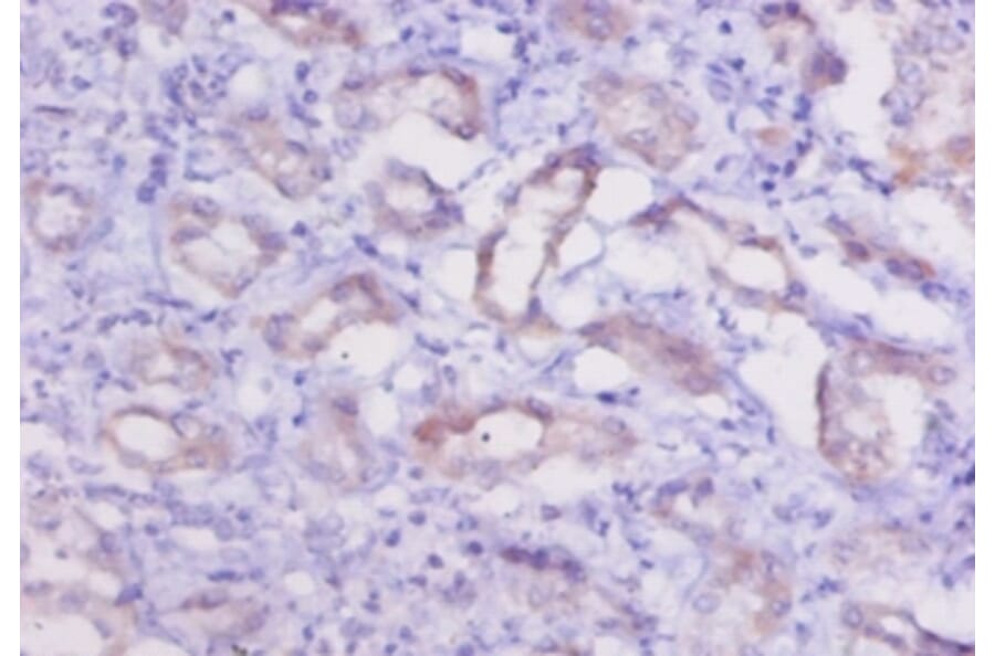 Immunohistochemistry - Cathepsin K Polyclonal Antibody from Signalway Antibody (42139) - Antibodies.com