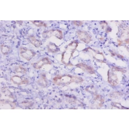 Immunohistochemistry - Cathepsin K Polyclonal Antibody from Signalway Antibody (42139) - Antibodies.com