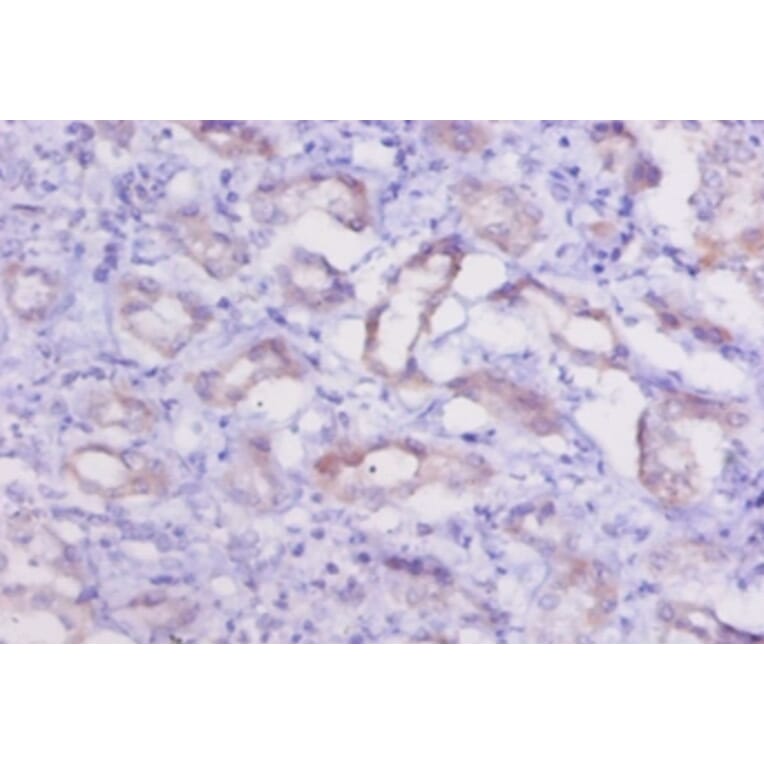 Immunohistochemistry - Cathepsin K Polyclonal Antibody from Signalway Antibody (42139) - Antibodies.com