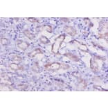 Immunohistochemistry - Cathepsin K Polyclonal Antibody from Signalway Antibody (42139) - Antibodies.com