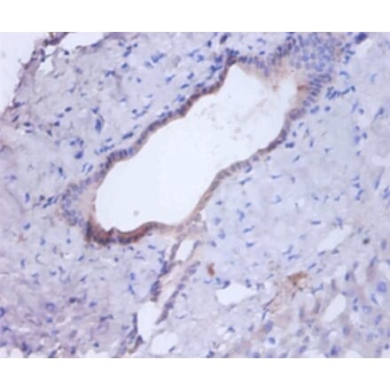 Immunohistochemistry - Cathepsin B Polyclonal Antibody from Signalway Antibody (42471) - Antibodies.com