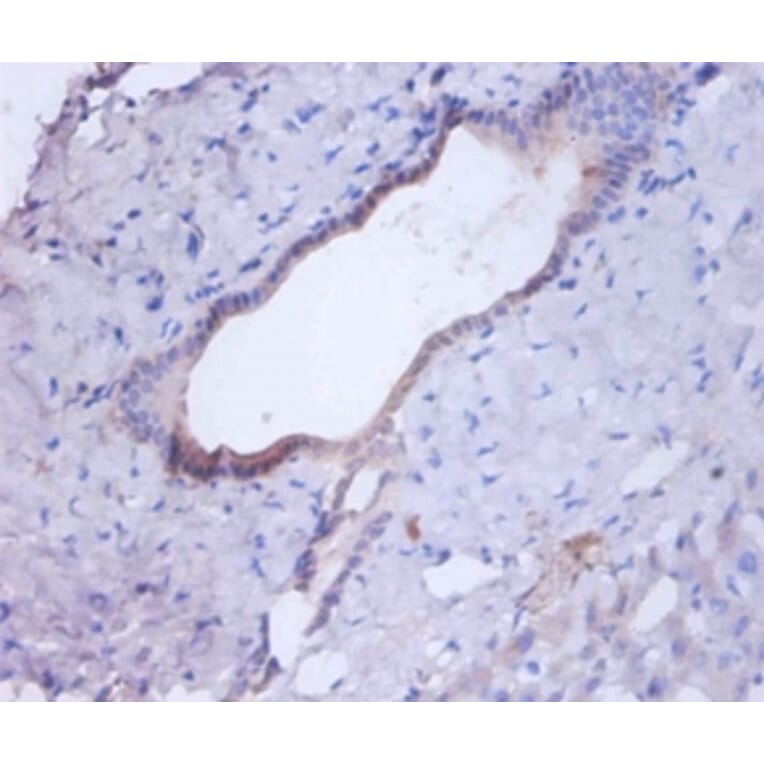 Immunohistochemistry - Cathepsin B Polyclonal Antibody from Signalway Antibody (42471) - Antibodies.com