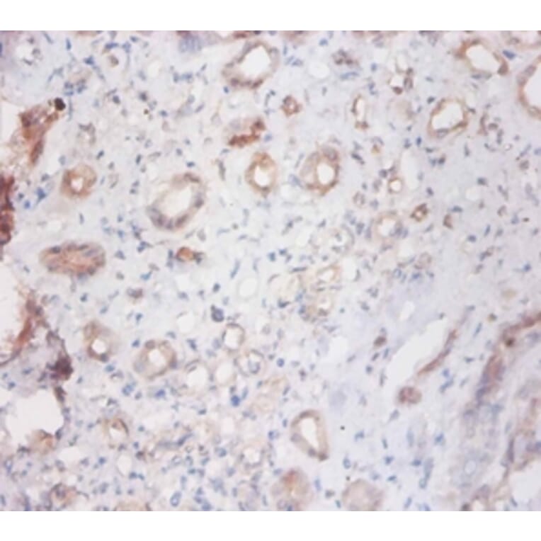 Immunohistochemistry - Cathepsin S Polyclonal Antibody from Signalway Antibody (42531) - Antibodies.com