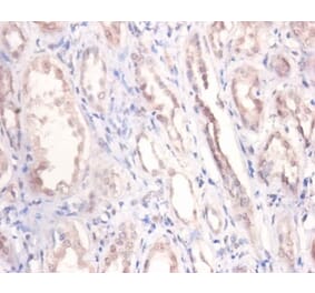 Immunohistochemistry - Podocalyxin Polyclonal Antibody from Signalway Antibody (42569) - Antibodies.com