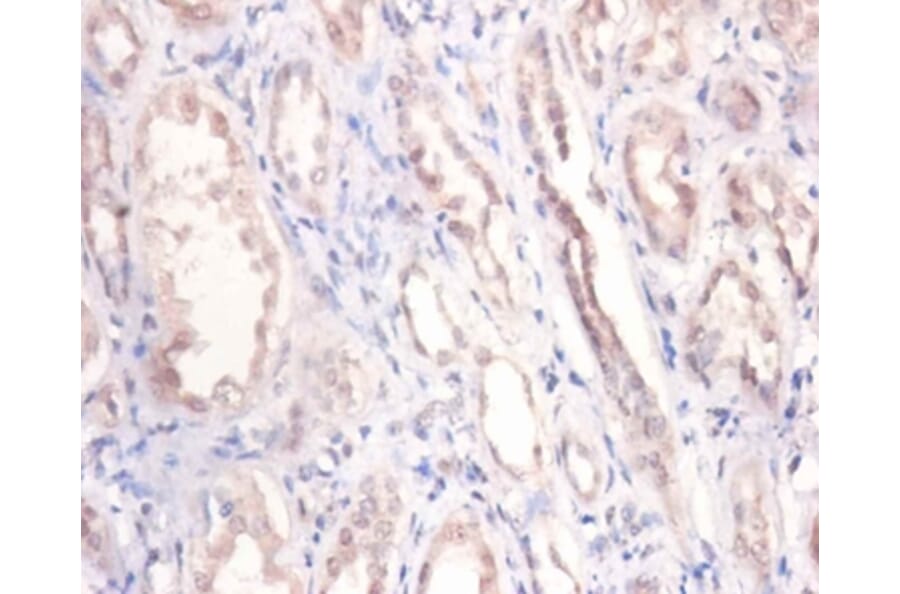Immunohistochemistry - Podocalyxin Polyclonal Antibody from Signalway Antibody (42569) - Antibodies.com
