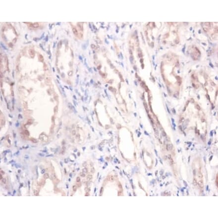 Immunohistochemistry - Podocalyxin Polyclonal Antibody from Signalway Antibody (42569) - Antibodies.com
