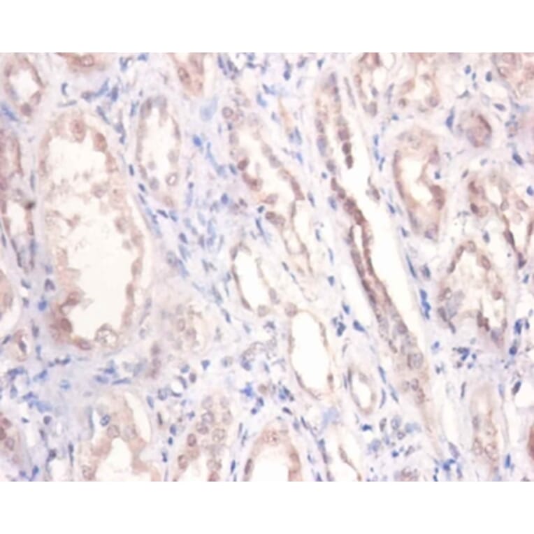 Immunohistochemistry - Podocalyxin Polyclonal Antibody from Signalway Antibody (42569) - Antibodies.com