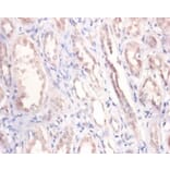 Immunohistochemistry - Podocalyxin Polyclonal Antibody from Signalway Antibody (42569) - Antibodies.com