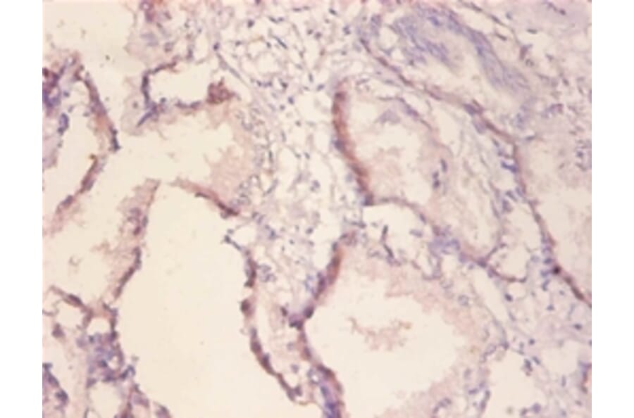 Immunohistochemistry - Receptor tyrosine-protein kinase erbB-2 Polyclonal Antibody from Signalway Antibody (42510)