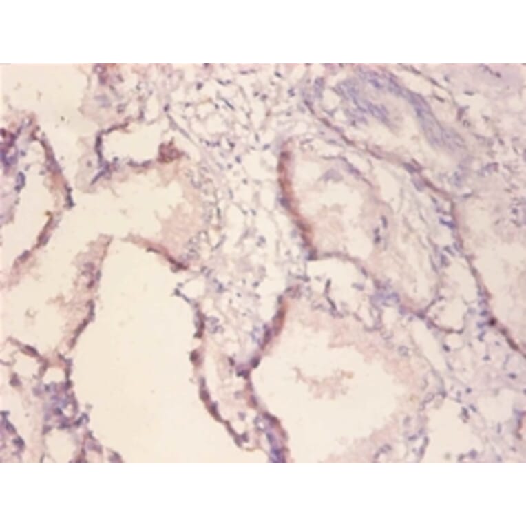 Immunohistochemistry - Receptor tyrosine-protein kinase erbB-2 Polyclonal Antibody from Signalway Antibody (42510)