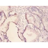 Immunohistochemistry - Receptor tyrosine-protein kinase erbB-2 Polyclonal Antibody from Signalway Antibody (42510)