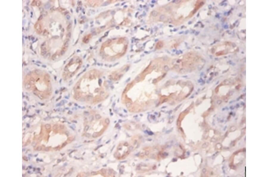 Immunohistochemistry - Receptor tyrosine-protein kinase erbB-2 Polyclonal Antibody from Signalway Antibody (42510)