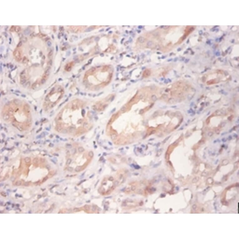 Immunohistochemistry - Receptor tyrosine-protein kinase erbB-2 Polyclonal Antibody from Signalway Antibody (42510)