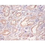 Immunohistochemistry - Receptor tyrosine-protein kinase erbB-2 Polyclonal Antibody from Signalway Antibody (42510)