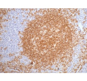 CD20 Mouse Monoclonal Antibody from Signalway Antibody (38003) - Antibodies.com