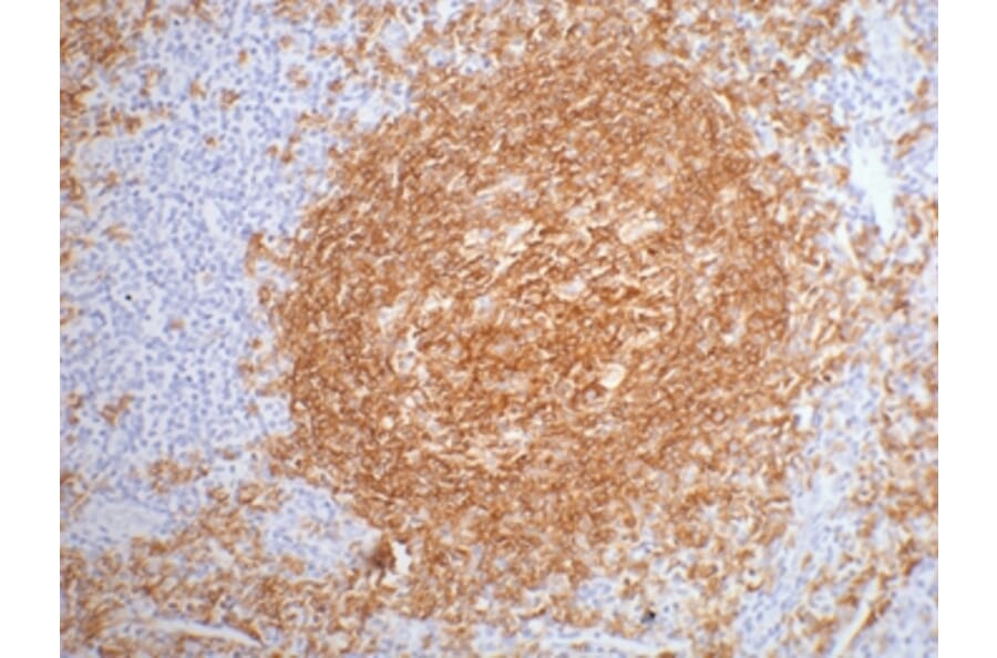 CD20 Mouse Monoclonal Antibody from Signalway Antibody (38003) - Antibodies.com