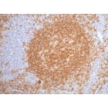CD20 Mouse Monoclonal Antibody from Signalway Antibody (38003) - Antibodies.com