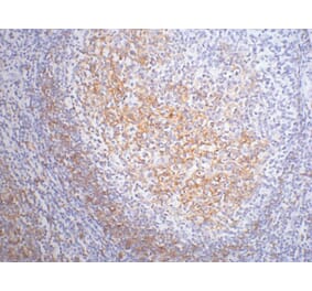 CD23 Mouse Monoclonal Antibody from Signalway Antibody (38004) - Antibodies.com