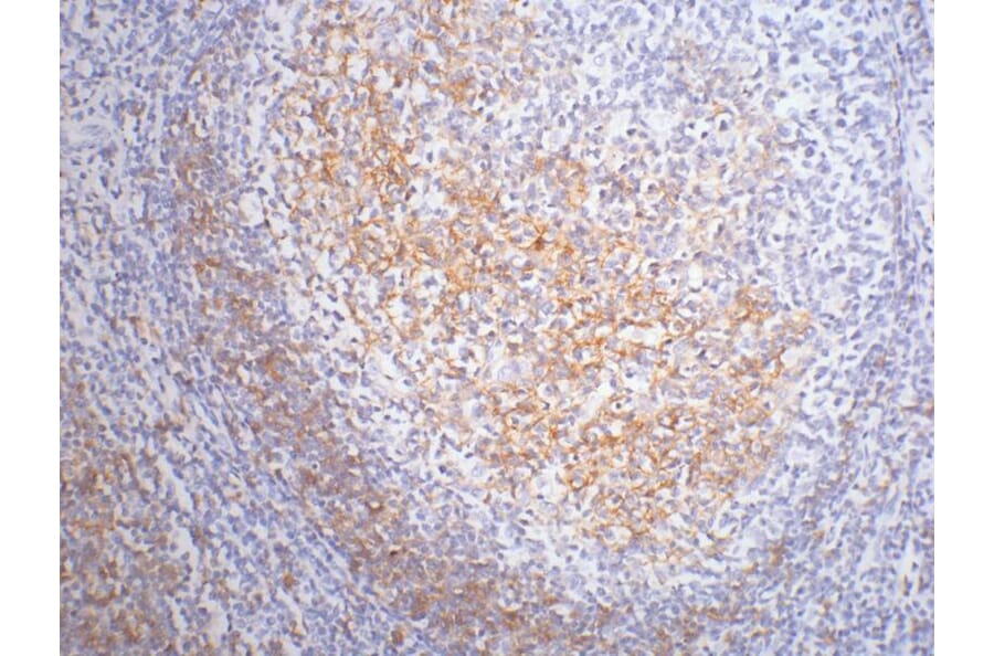 CD23 Mouse Monoclonal Antibody from Signalway Antibody (38004) - Antibodies.com