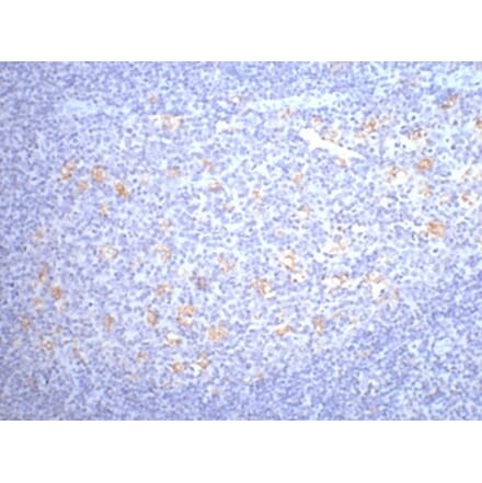 CD68 Mouse Monoclonal Antibody from Signalway Antibody (38005) - Antibodies.com