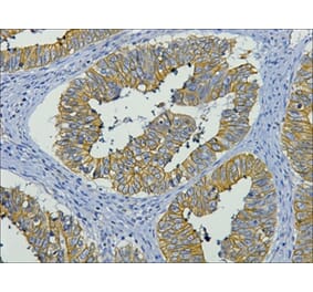 CK19 Mouse Monoclonal Antibody from Signalway Antibody (38006) - Antibodies.com