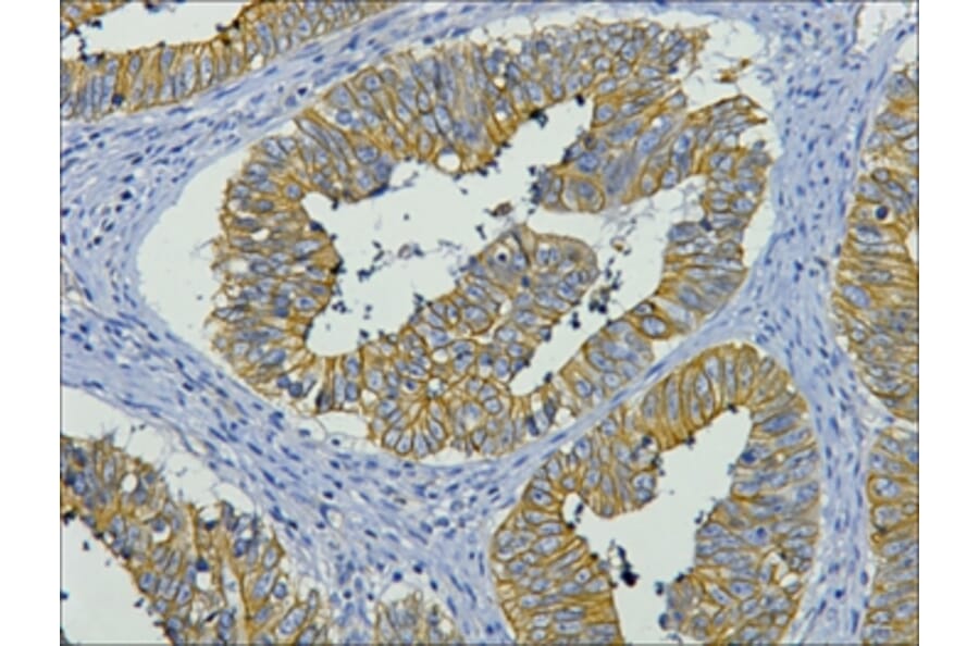 CK19 Mouse Monoclonal Antibody from Signalway Antibody (38006) - Antibodies.com