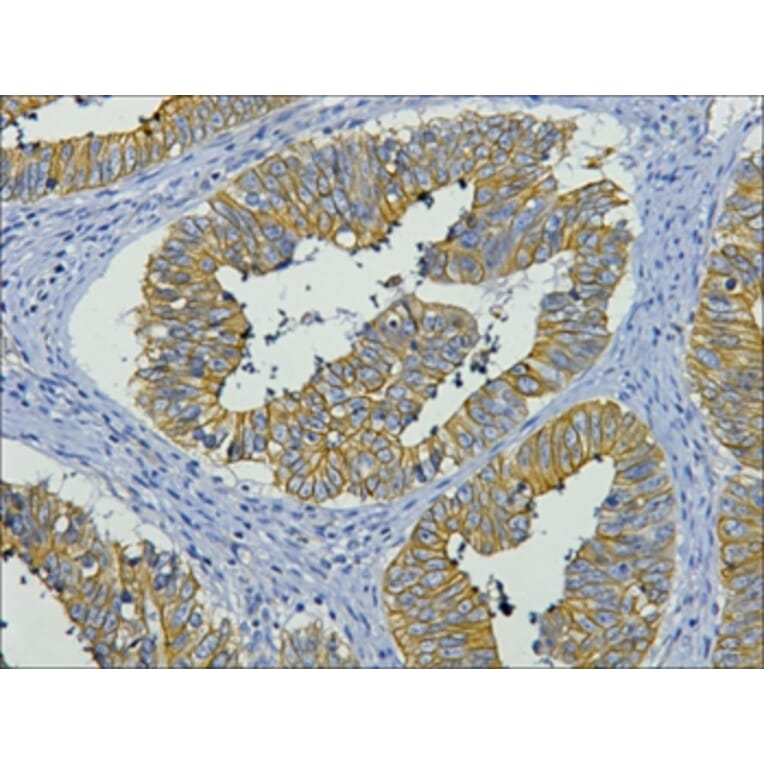 CK19 Mouse Monoclonal Antibody from Signalway Antibody (38006) - Antibodies.com