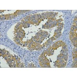 CK19 Mouse Monoclonal Antibody from Signalway Antibody (38006) - Antibodies.com