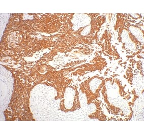 CK16 Mouse Monoclonal Antibody from Signalway Antibody (38011) - Antibodies.com