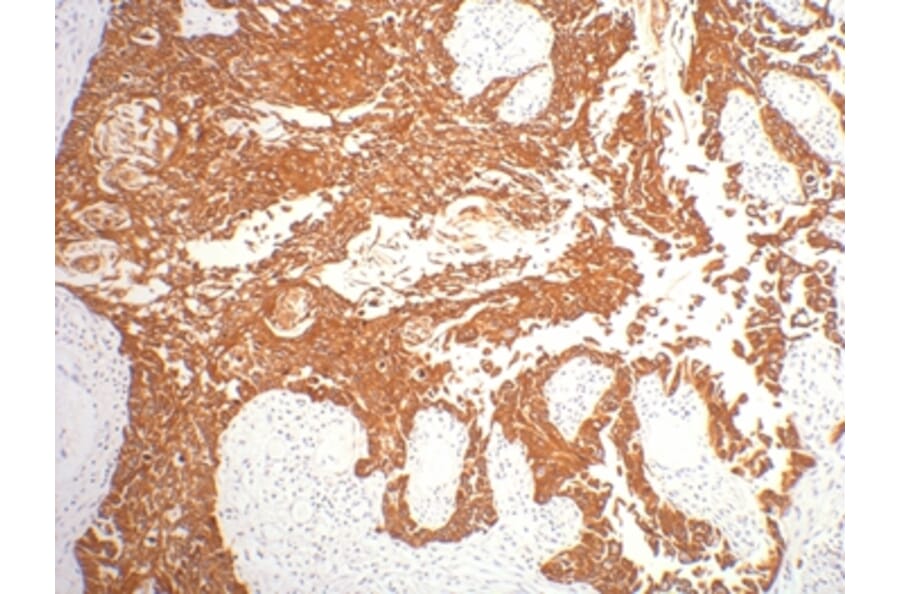 CK16 Mouse Monoclonal Antibody from Signalway Antibody (38011) - Antibodies.com