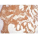 CK16 Mouse Monoclonal Antibody from Signalway Antibody (38011) - Antibodies.com