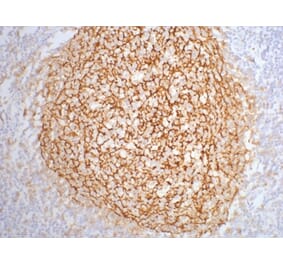 CD21 Mouse Monoclonal Antibody from Signalway Antibody (38015) - Antibodies.com