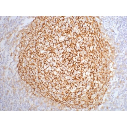 CD21 Mouse Monoclonal Antibody from Signalway Antibody (38015) - Antibodies.com