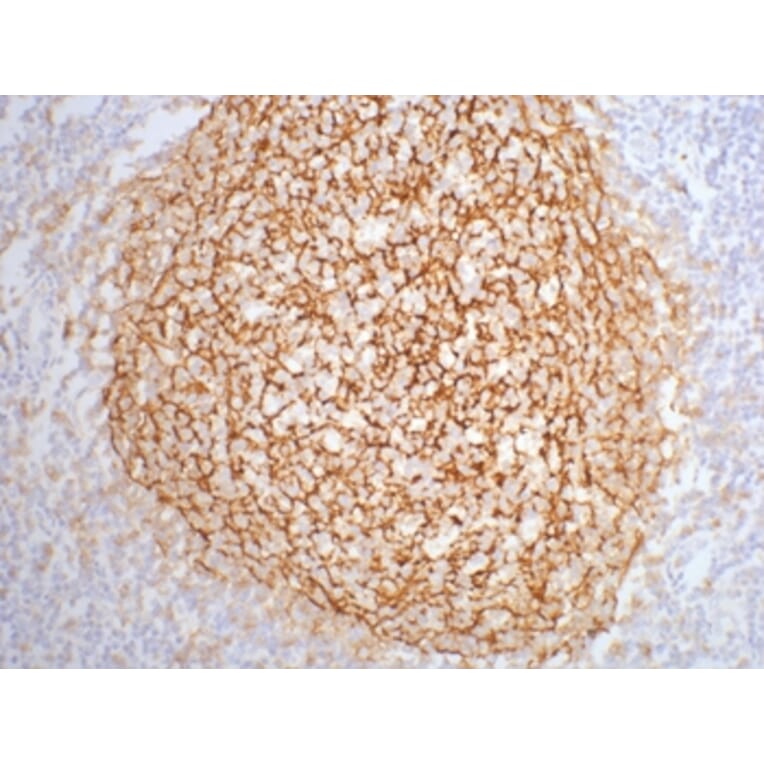 CD21 Mouse Monoclonal Antibody from Signalway Antibody (38015) - Antibodies.com