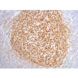 CD21 Mouse Monoclonal Antibody from Signalway Antibody (38015) - Antibodies.com
