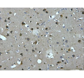 MAP2 Mouse Monoclonal Antibody from Signalway Antibody (38022) - Antibodies.com