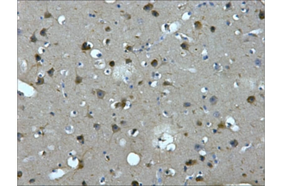 MAP2 Mouse Monoclonal Antibody from Signalway Antibody (38022) - Antibodies.com