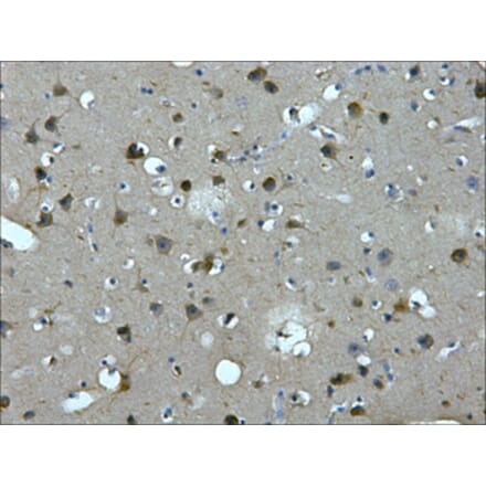 MAP2 Mouse Monoclonal Antibody from Signalway Antibody (38022) - Antibodies.com