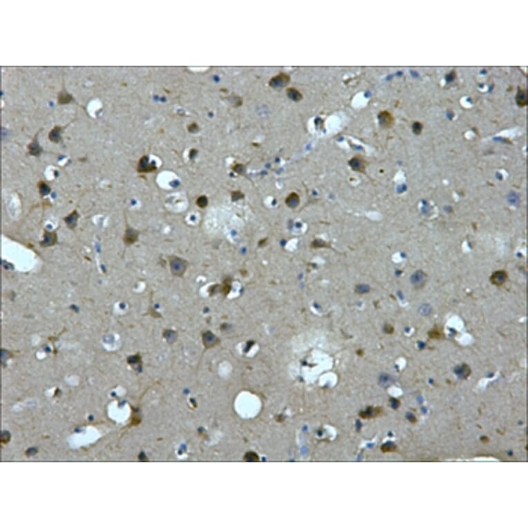 MAP2 Mouse Monoclonal Antibody from Signalway Antibody (38022) - Antibodies.com