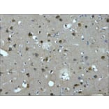 MAP2 Mouse Monoclonal Antibody from Signalway Antibody (38022) - Antibodies.com