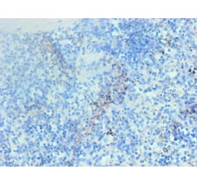 Immunohistochemistry - Hemoglobin Monoclonal Antibody from Signalway Antibody (42015) - Antibodies.com