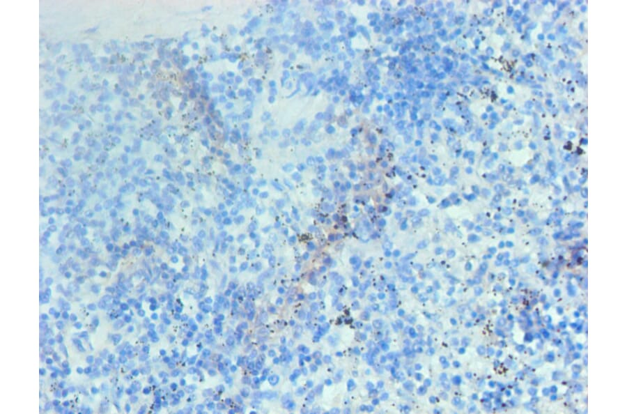 Immunohistochemistry - Hemoglobin Monoclonal Antibody from Signalway Antibody (42015) - Antibodies.com