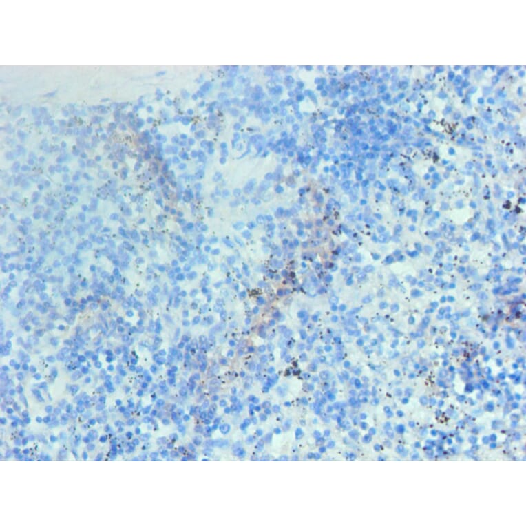 Immunohistochemistry - Hemoglobin Monoclonal Antibody from Signalway Antibody (42015) - Antibodies.com
