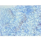 Immunohistochemistry - Hemoglobin Monoclonal Antibody from Signalway Antibody (42015) - Antibodies.com